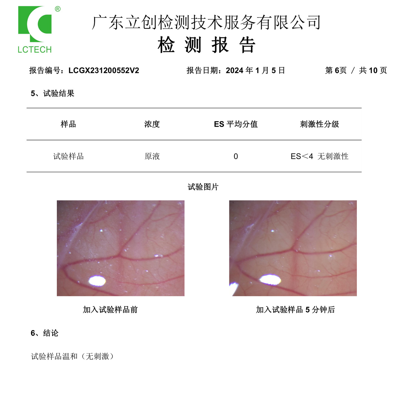白细胞提取物HET-CAM温和性报告截图